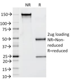 Kallikrein 3/PSA Antibody (KLK3/1248), Novus Biologicals 0.2mg; Unlabeled:Antibodies,